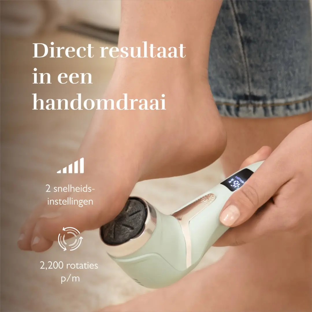 Silk'n FreshPedi Elektrische Eeltverwijderaar FP1PE1M001 - Mint