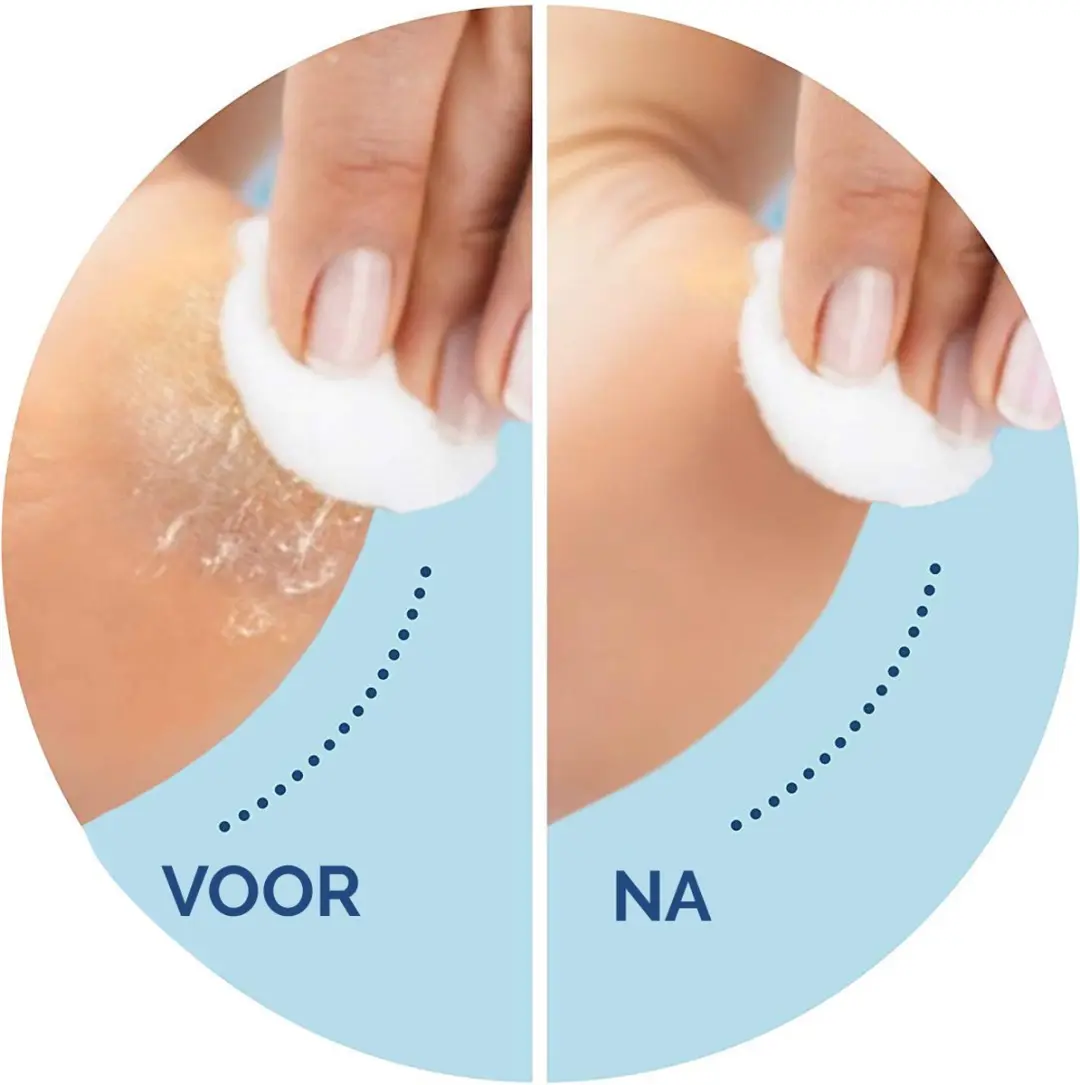 Scholl Voetvijl Navulling Velvet Smooth - 8 Stuks