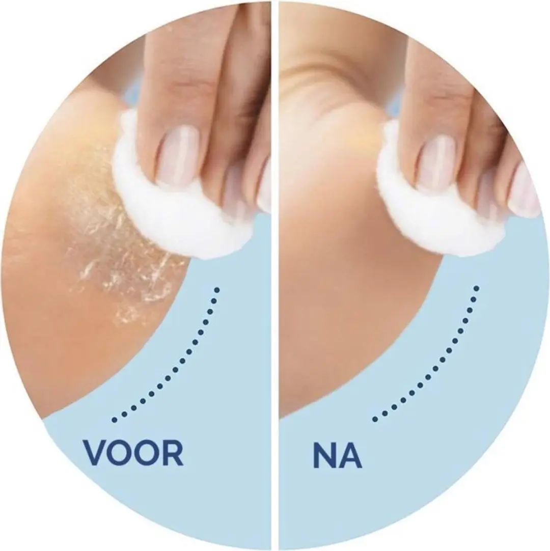 Scholl Velvet Smooth Voetverzorgingsapparaat - Paars - 2 Stuks