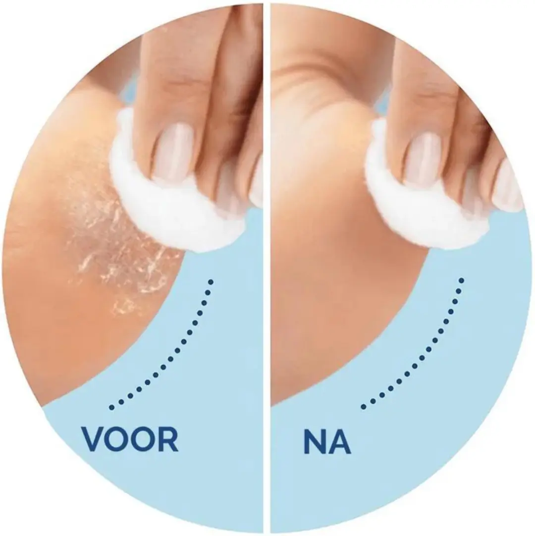 Scholl Velvet Smooth Elektrische Eeltverwijderaar - Blauw - 5 Stuks
