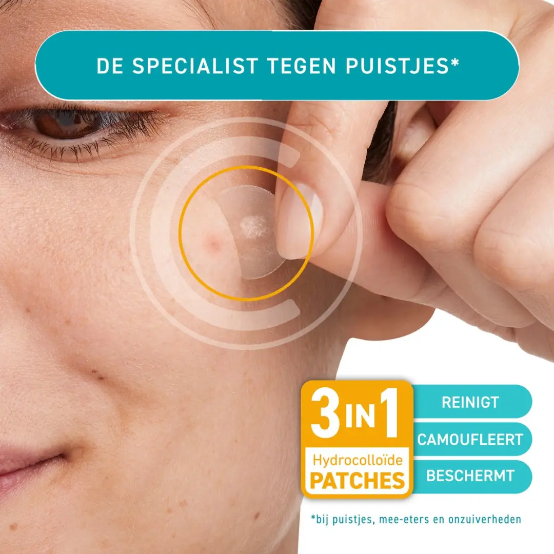 Compeed Anti-Spots Conceal & Go Pimple Patches - 15 Stuks