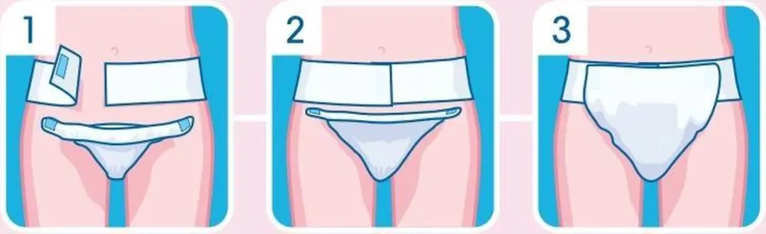 TENA Flex Ultima Medium - 20 Stuks