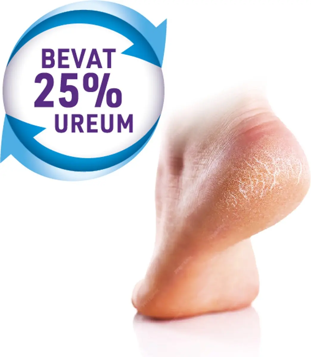 Mycosan Hielkloven Zalf 75ml