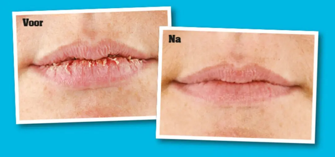 O'Keeffe's Liprepair Lippenbalsem 4,2g - Oranje
