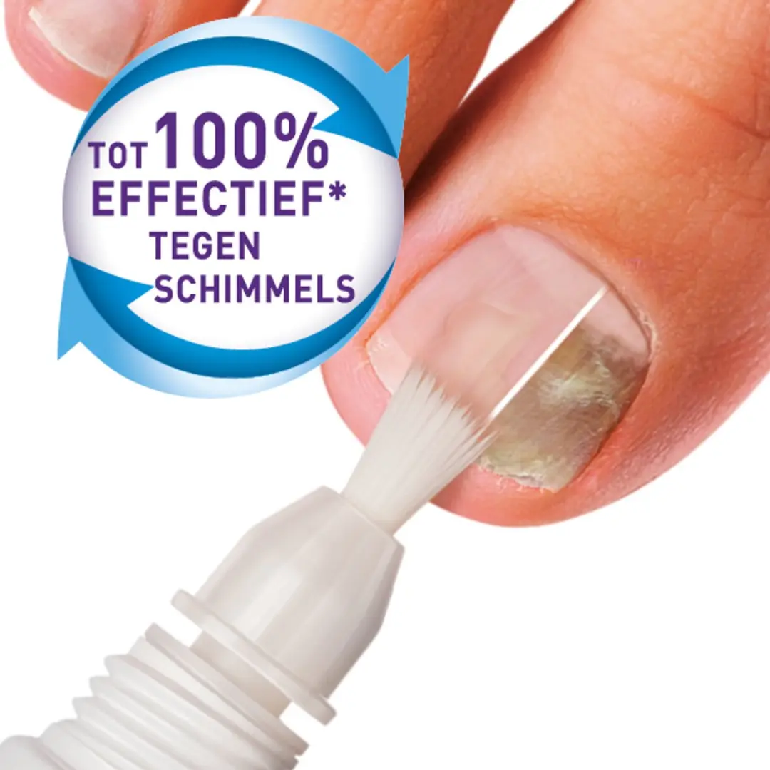 Mycosan Behandelset Kalknagel 5ml - Incl. kwast & vijlen