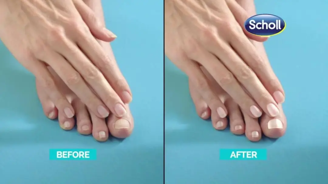 Scholl Velvet Smooth Ontharingsapparaat - Blauw/Wit