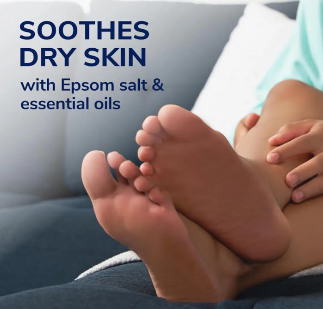 Scholl Voetcrème 103ml - Droge & Schilferige Huid
