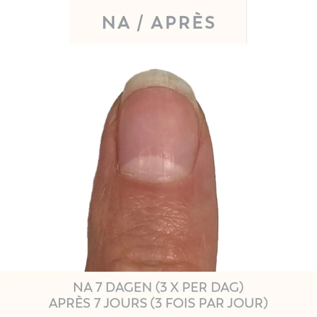 Cobra Nail Restore Serum 10ml