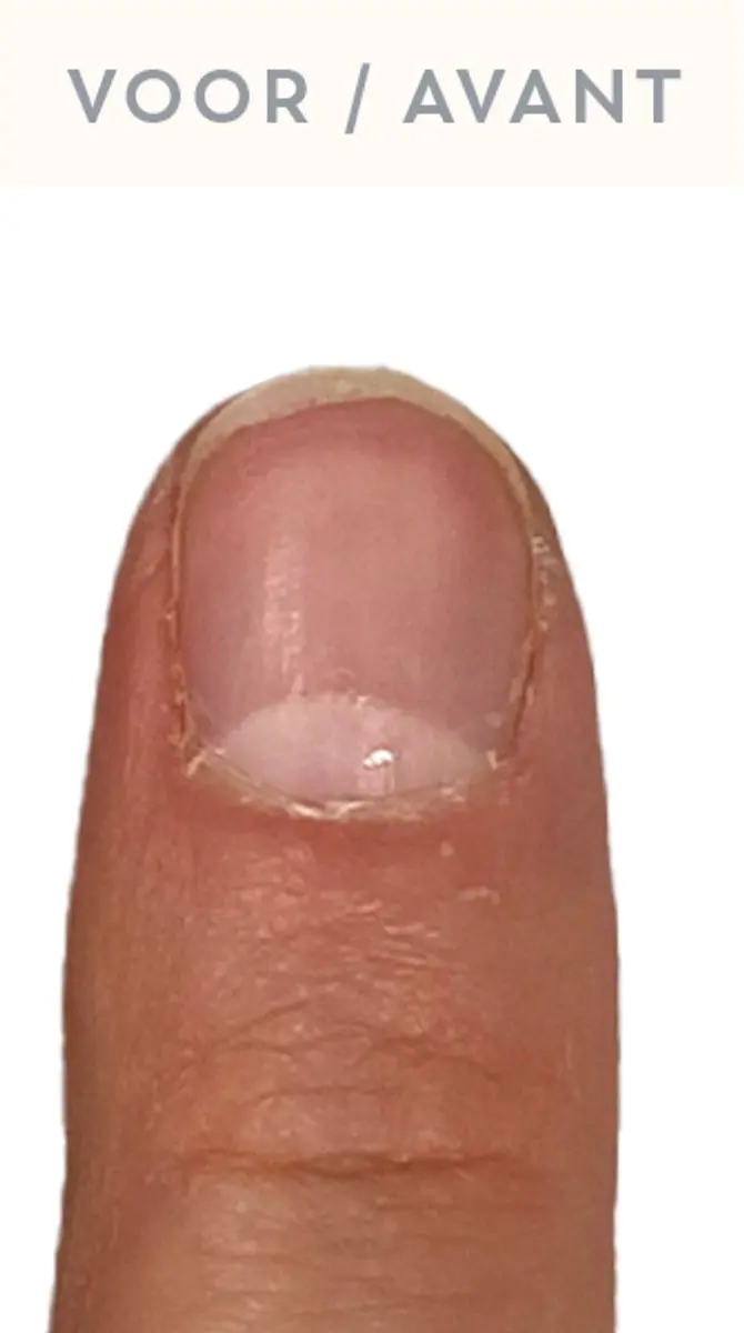 Cobra Nail Restore Serum 10ml