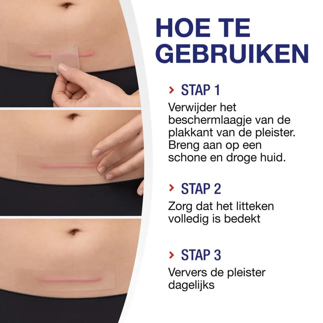 Hansaplast Littekenvervager XL Pleisters 21 Stuks - 3x14,6cm Transparant