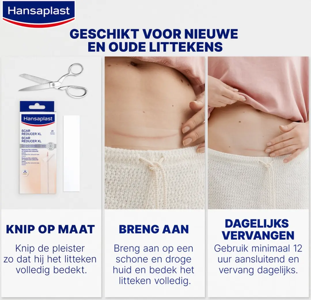 Hansaplast Littekenvervager XL Pleisters 21 Stuks - 3x14,6cm Transparant
