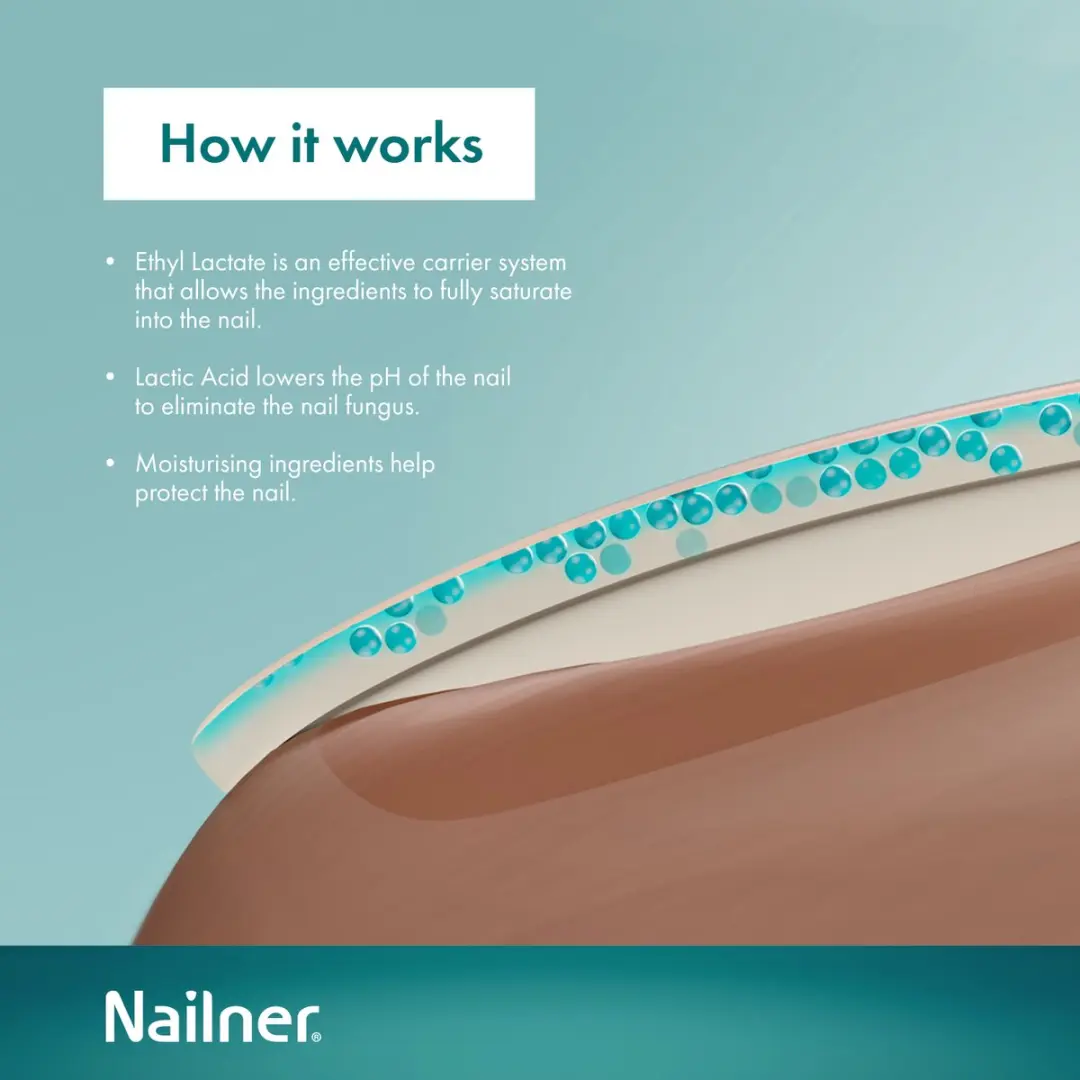 Nailner Kalknagelkwastje 5ml
