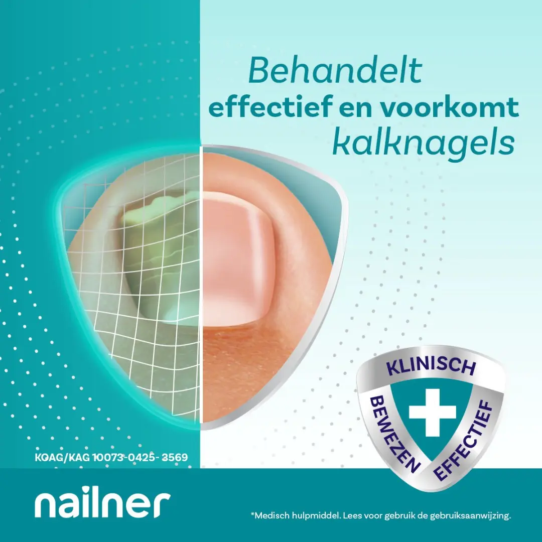 Nailner Kalknagelkwastje Multi-Action 5ml