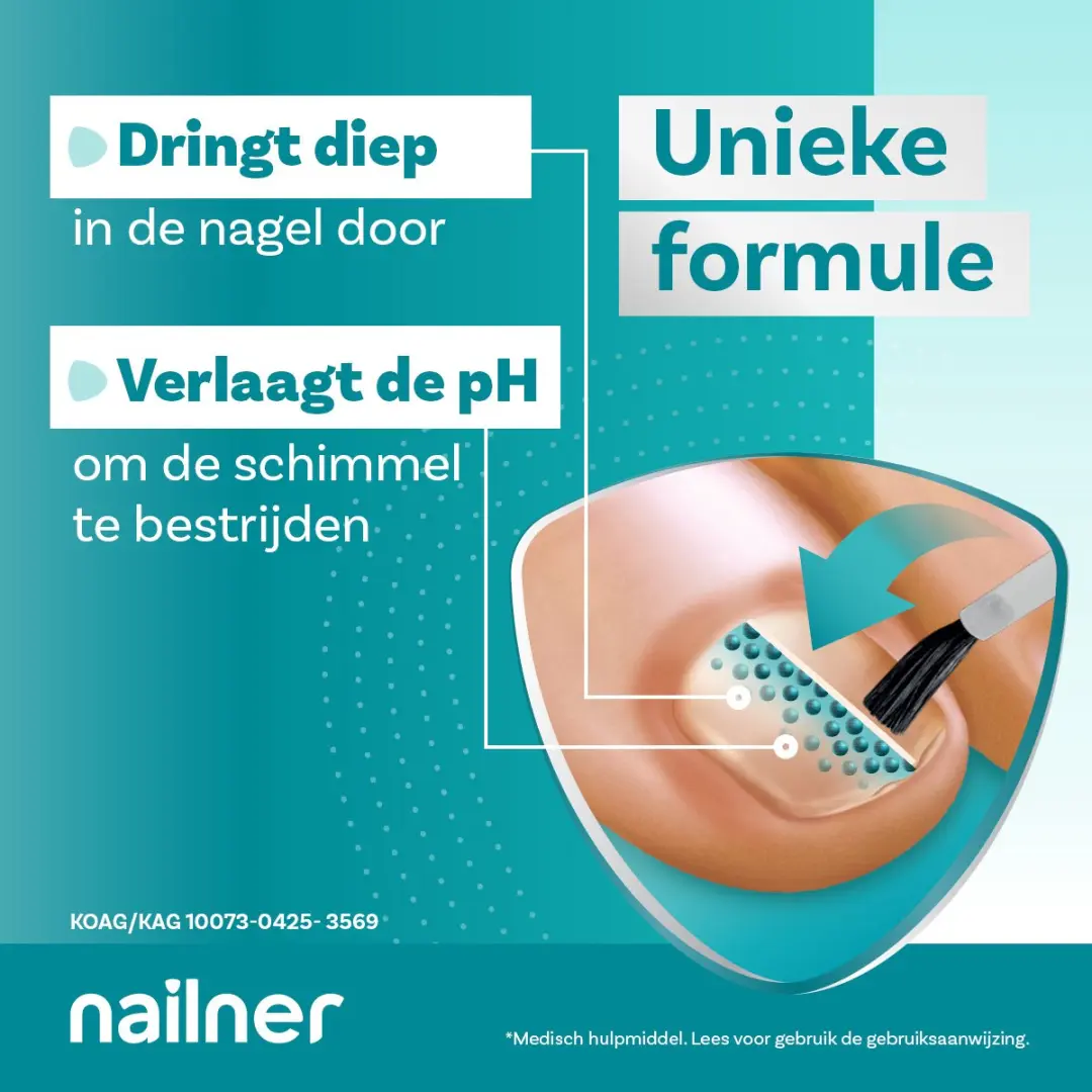 Nailner Kalknagelkwastje Multi-Action 5ml