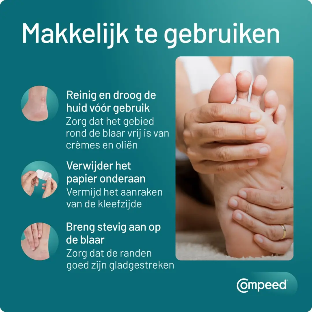 Compeed Blarenpleisters Mixpack - 10 Stuks