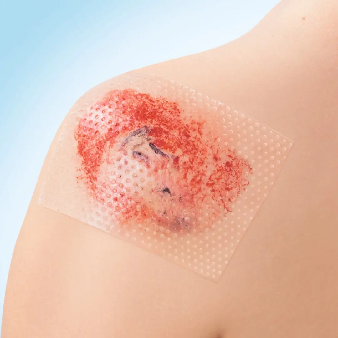 Leukoplast Cuticell Contact Siliconen Wondcontactlaag 5x7,5cm - 15 Stuks