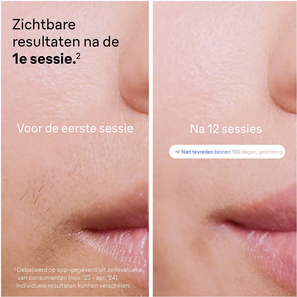Braun Smart PL7253 Skin i·expert IPL Ontharingsapparaat - 400.000 flitsen - Wit