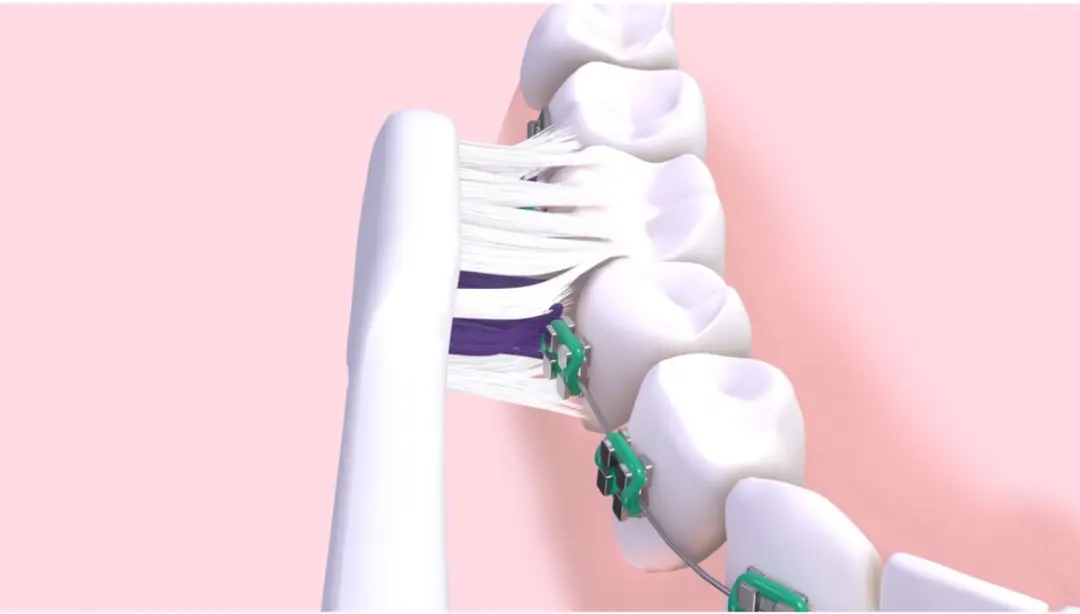Gum Sonic Ortho Elektrische Tandenborstel - Paars/wit