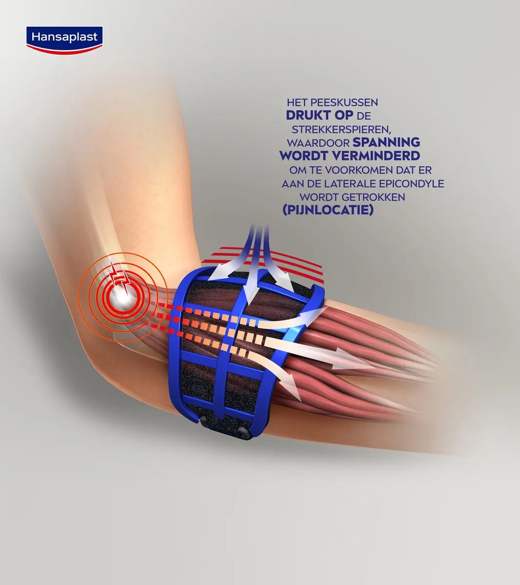 Hansaplast Sport Tenniselleboogbandage - Zwart