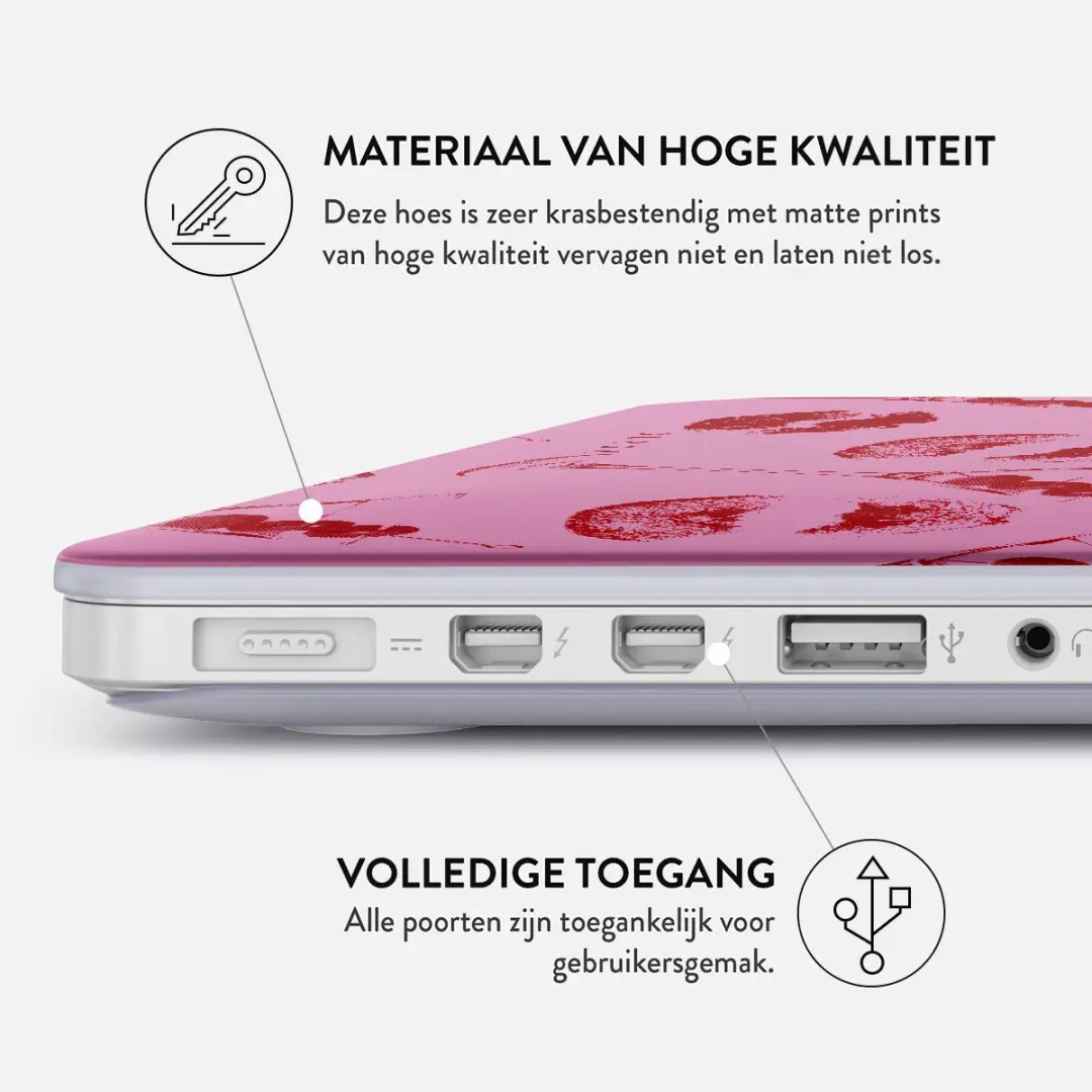 Burga Hardshell Cover MacBook Pro 16" - Call Me - PA_03M_MBP16_A2485