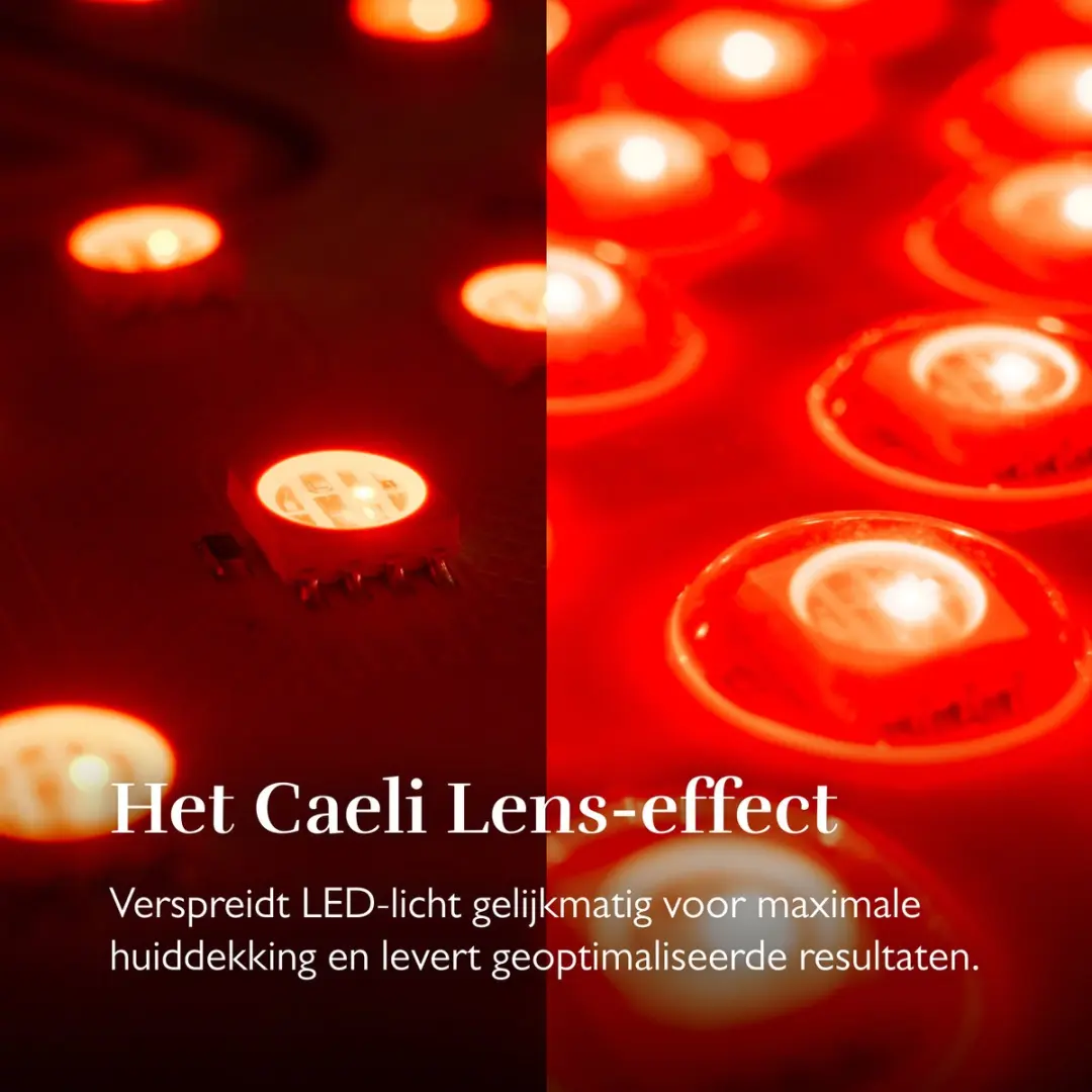 Silk'n LED Face Mask Pro FLMP1PE1001 - Roze - afbeelding 6 van 6