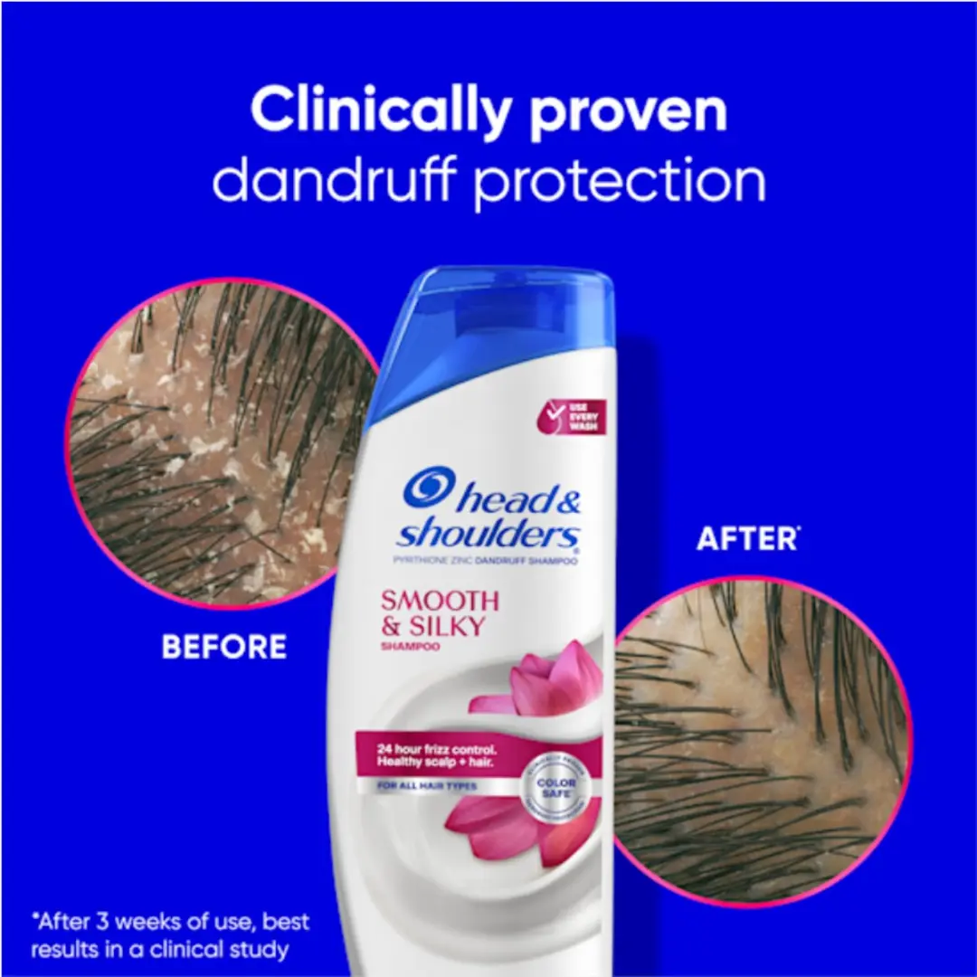 Head & Shoulders Anti-Roos Shampoo Smooth & Silky - 6x250ml