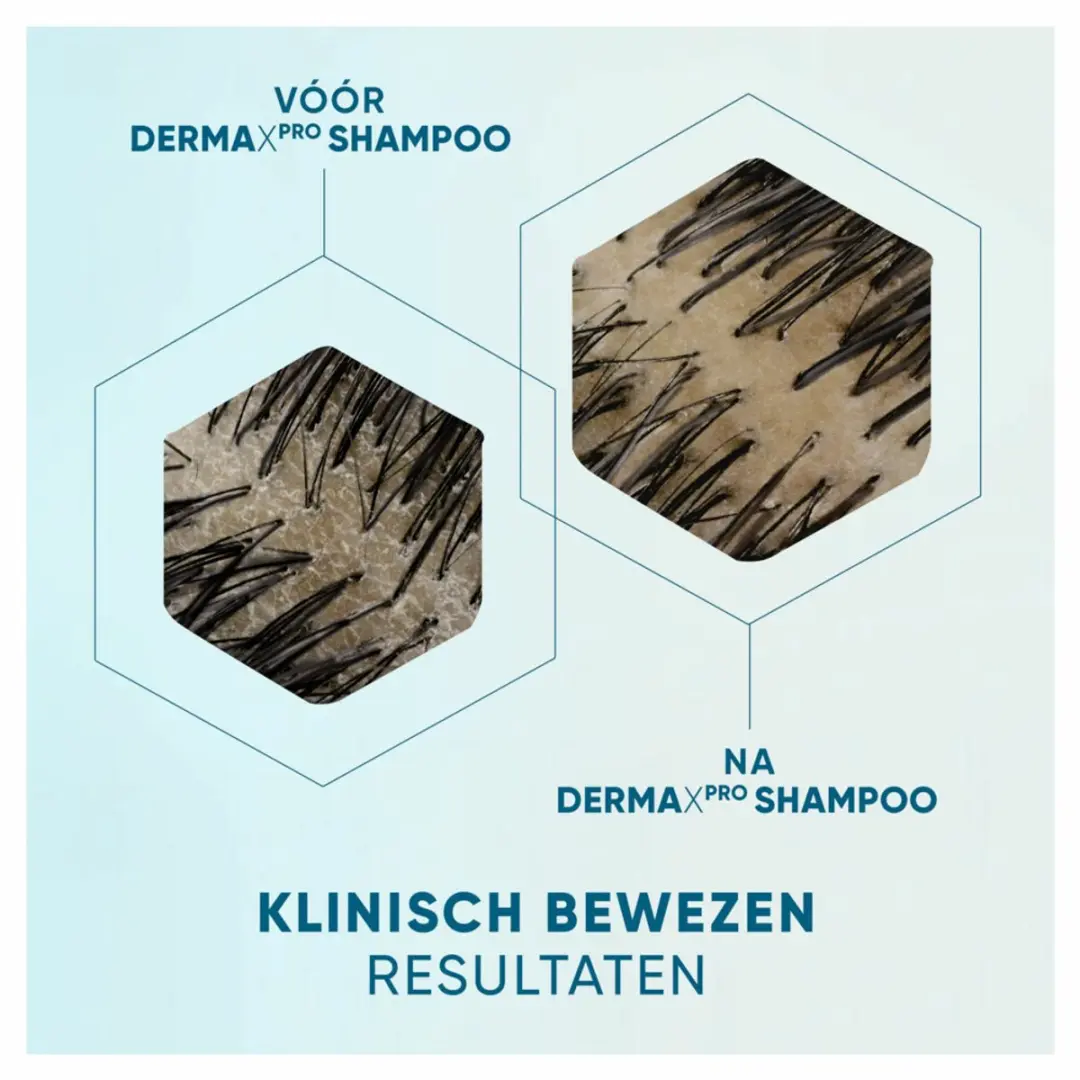 Head & Shoulders DermaXPro Kalmeert Shampoo 250ml - 4 Stuks
