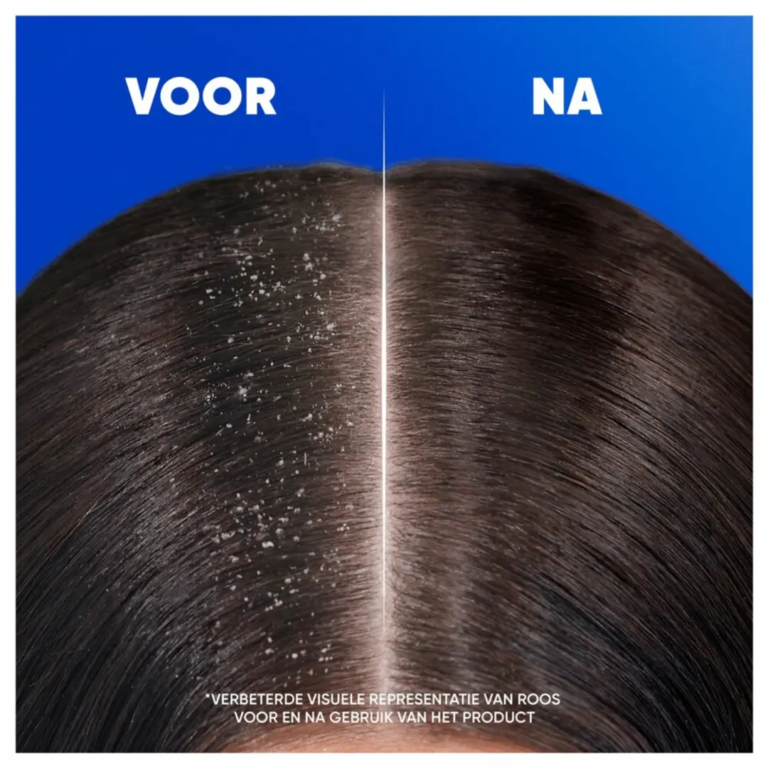 Head & Shoulders Apple Fresh 2-in-1 Shampoo 300ml - 5 Stuks