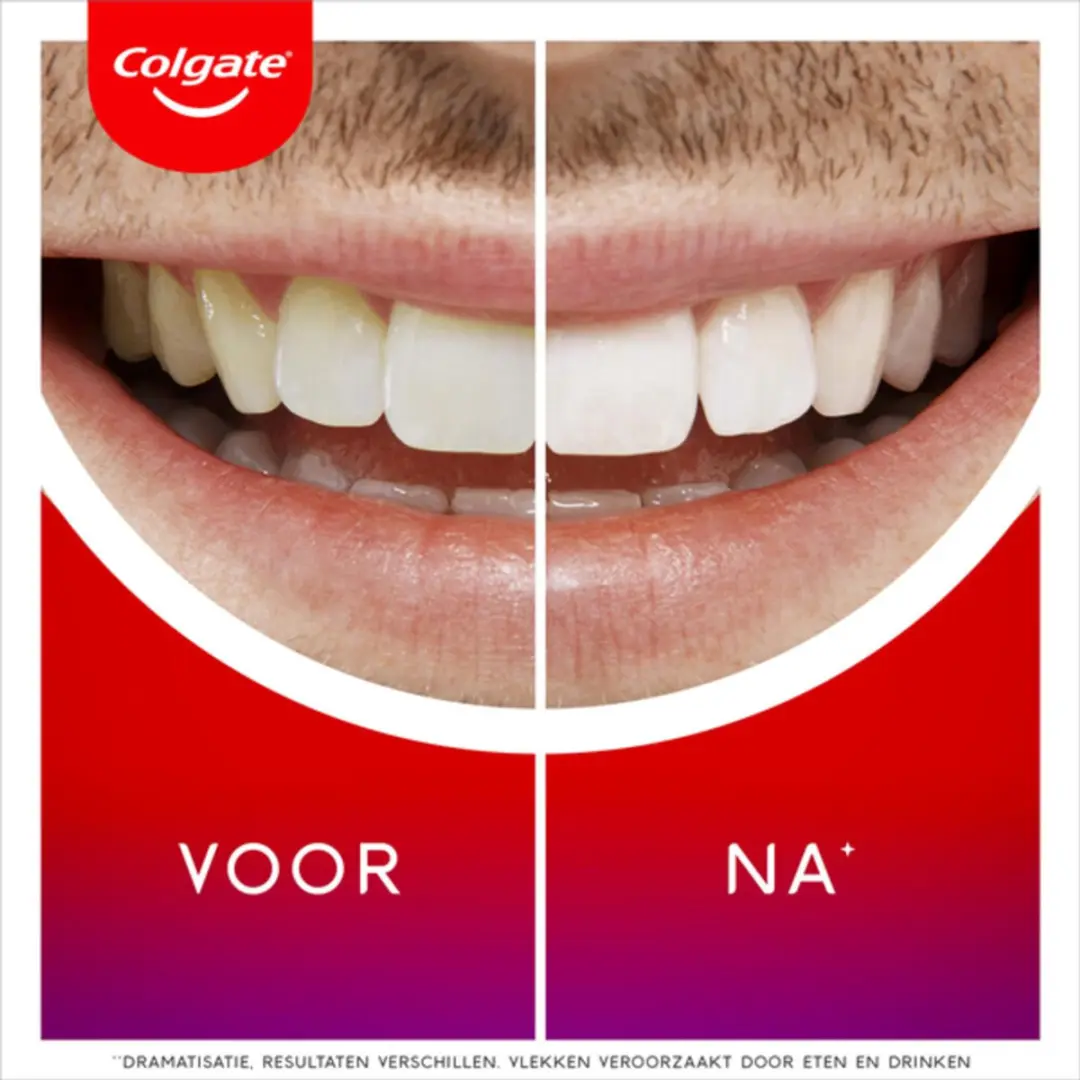 Colgate Max White Overnight Whitening Serum 2,5ml - 10 Stuks
