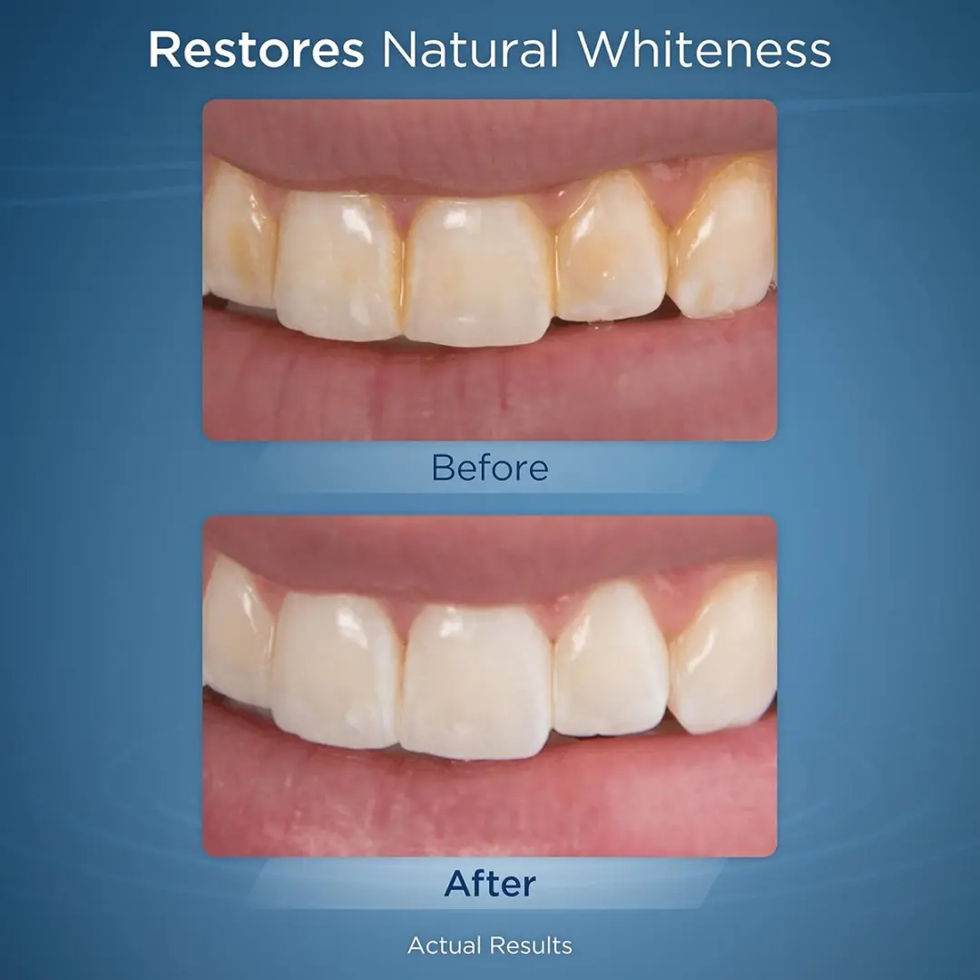 Waterpik Whitening WF-05 Flosapparaat - 10 Snelheden - Wit