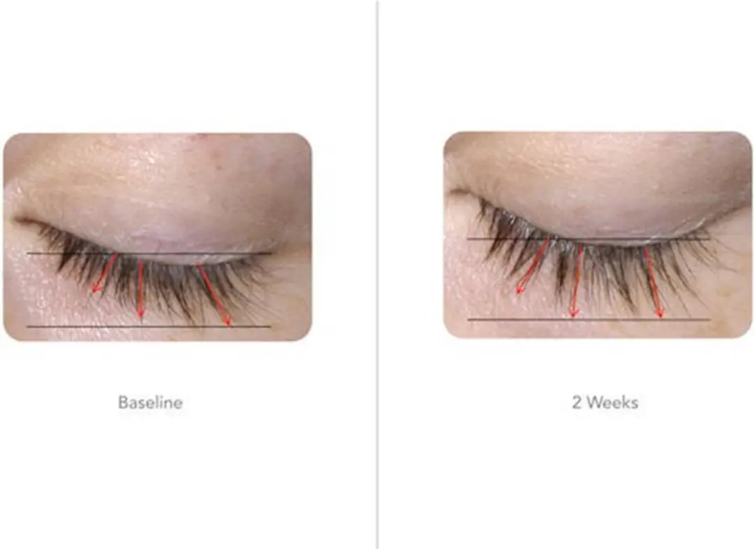 Foligain LASH Wimper Verlenger Serum 5ml