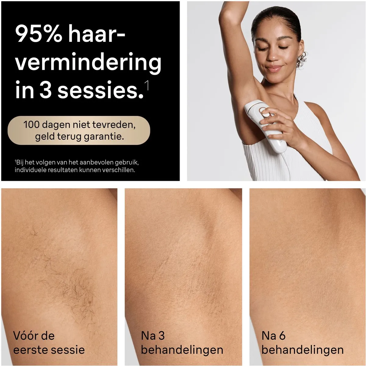 Braun Silk·expert Pro 5 PL5311 IPL Ontharingsapparaat - 400.000 Flitsen - Wit