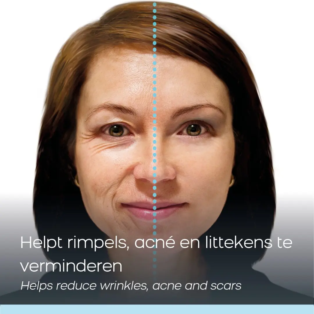 Celltone Slakkenslijmcrème 2x50ml - Anti-rimpel & Acneverzorging