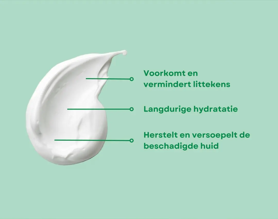 ALHYDRAN 30ml Littekencrème - Brandwondencrème