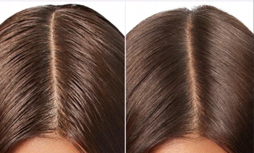 L'Oréal Paris Elseve Hyaluron Verhelderend Shampoo 400ml