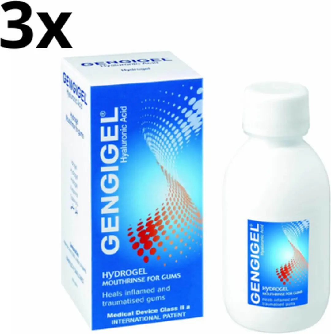 Gengigel Tandgel