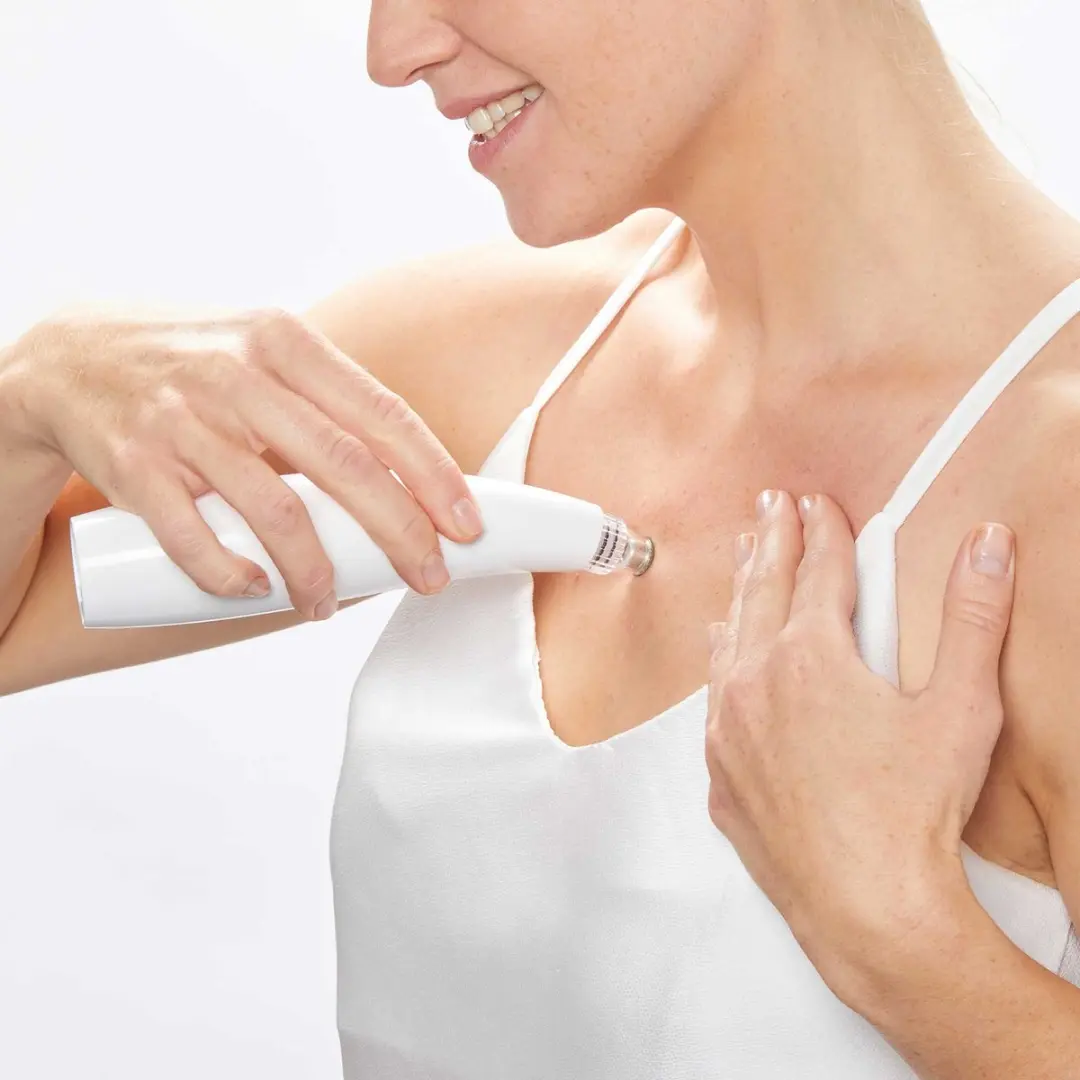 Lanaform Limpia Poriënreiniger - Wit