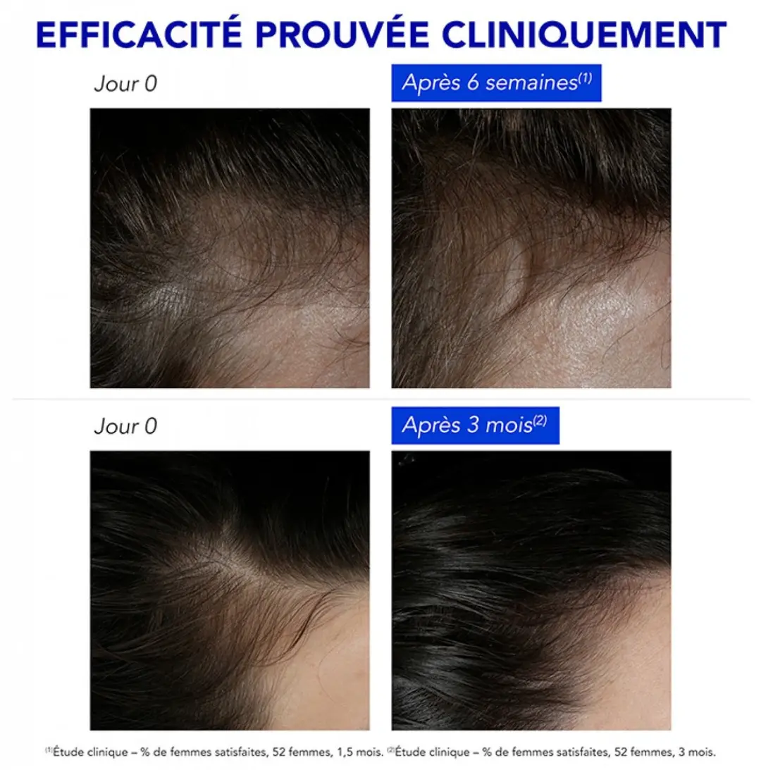 Phyto Phytophanère Anti-Haaruitval 60ml - 12x5ml