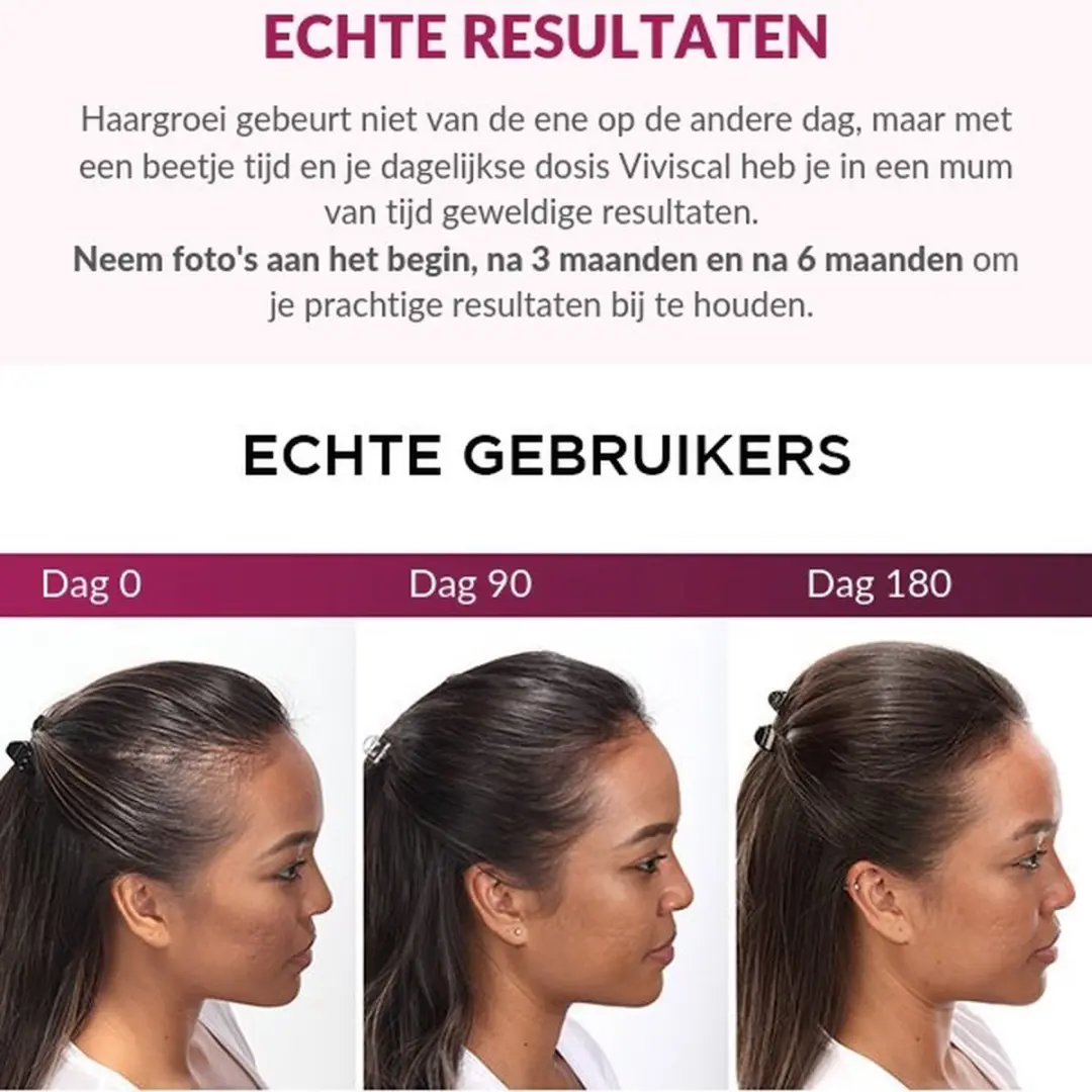 Viviscal Maximale Haargroei Set - 60 Stuks + Shampoo 250ml + Conditioner