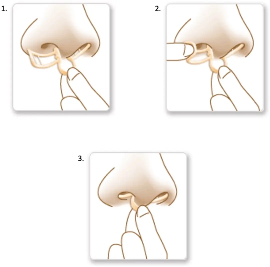 SleepRight Nasal Breathe Aid Neusspreider - 2 Stuks