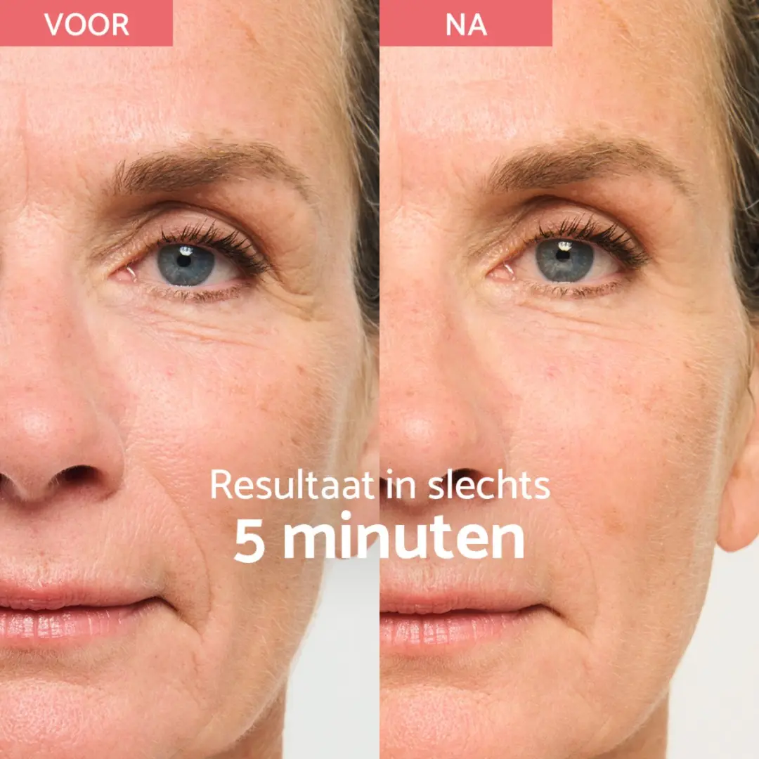 Remescar Instant Facelift Crème 40ml