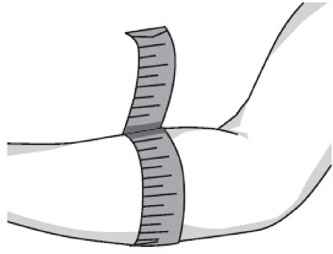 Thuasne Epi Med Elleboogbrace XS - Wit