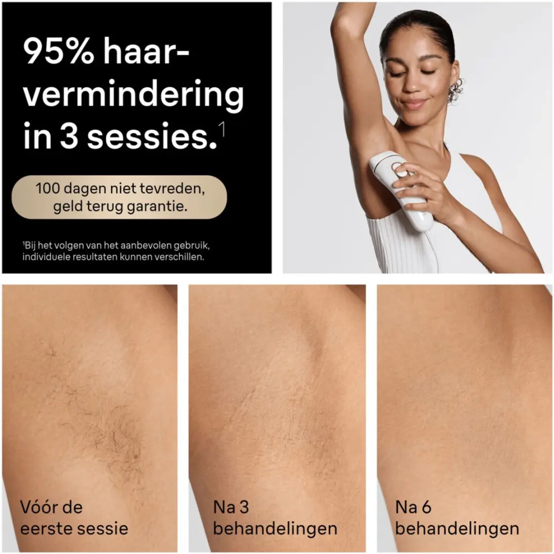 Braun IPL Silk-Expert Pro 5 PL5234 - Ontharingsapparaat - afbeelding 6 van 6