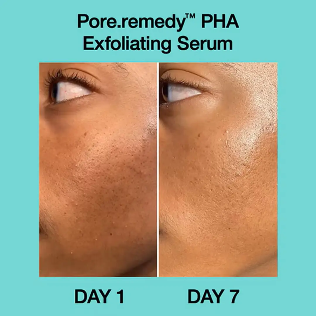 Dr.Jart+ Pore Remedy PHA Exfoliating Serum 30ml