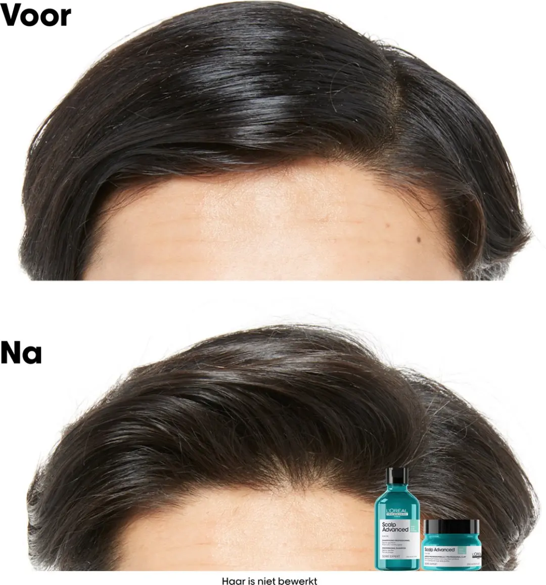 L'Oréal Professionnel Scalp Advanced Anti-Oiliness Clay 250ml