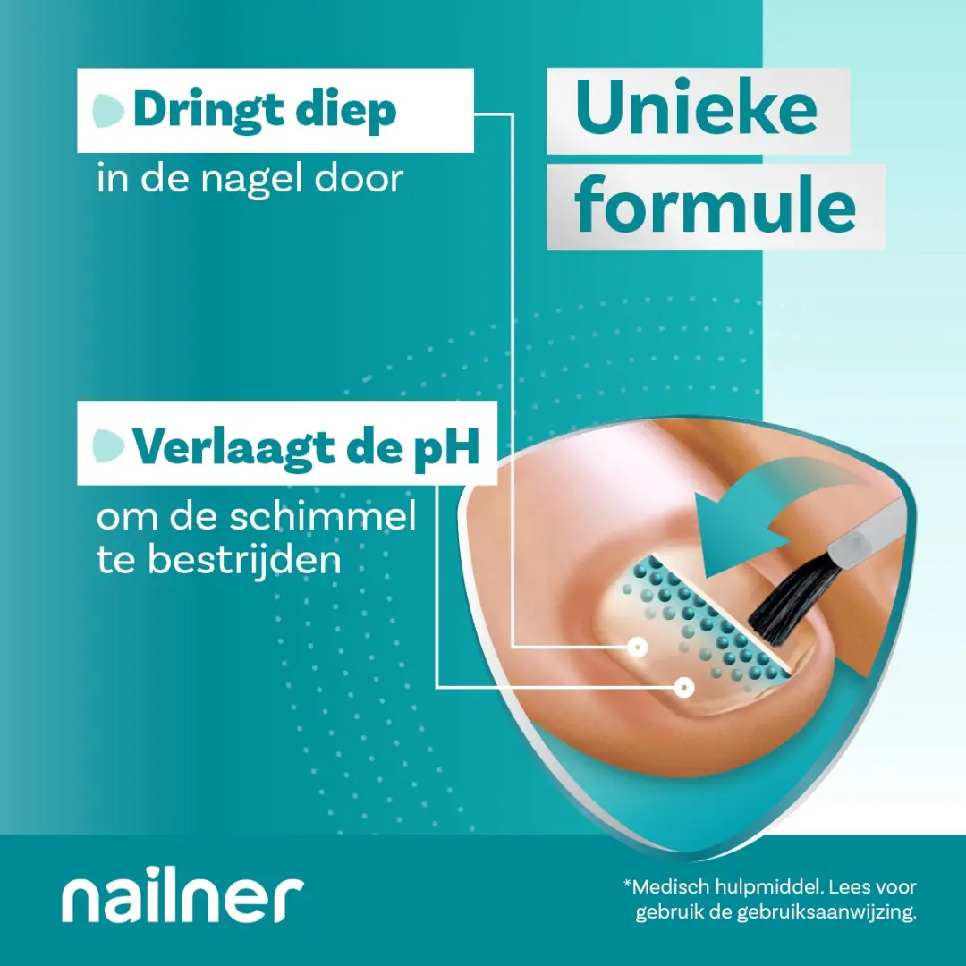 Nailner Kalknagelbehandeling 10ml