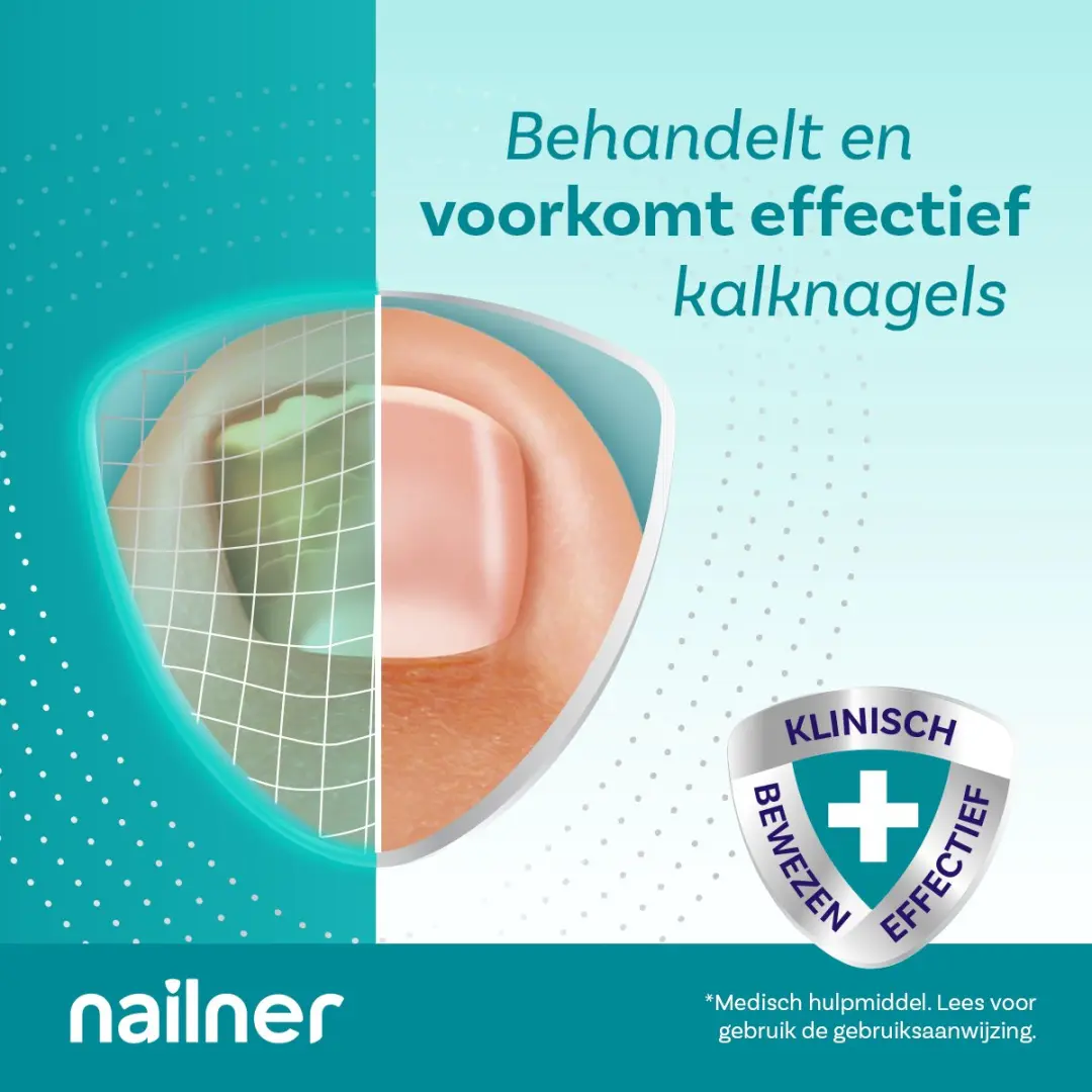 Nailner Kalknagelbehandeling 10ml