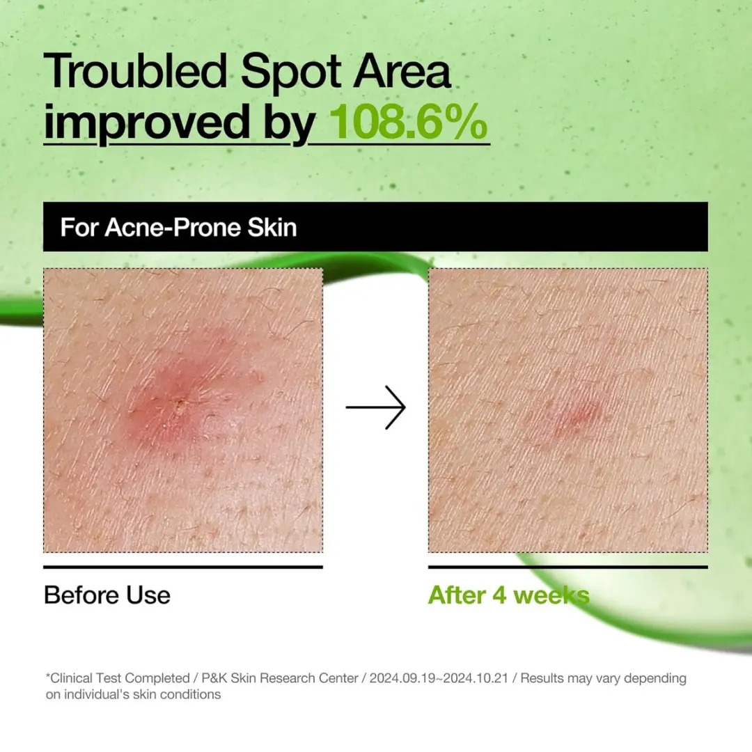 Anua Azelaic Acid 10% Hyaluron Serum 30ml