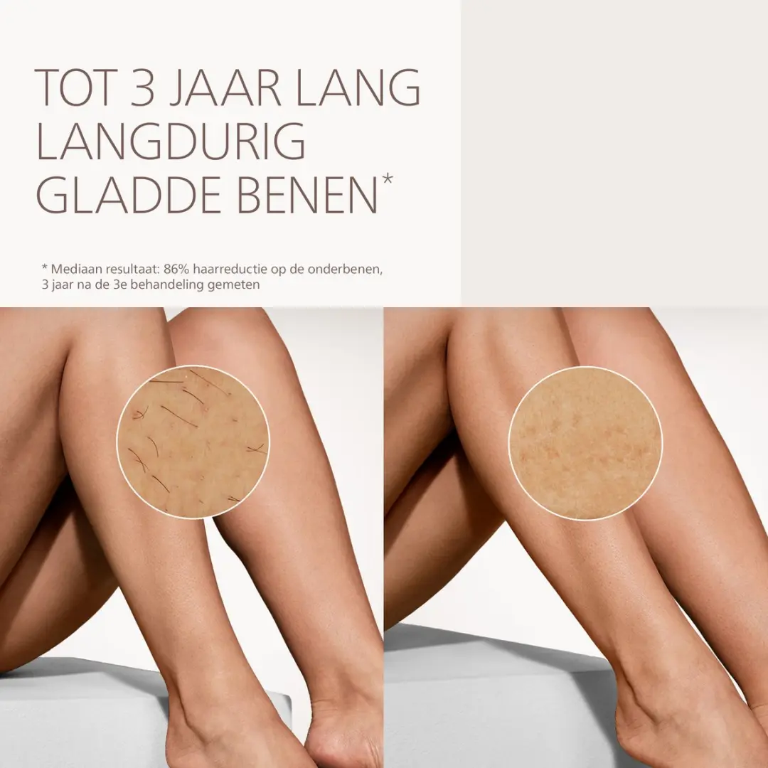 Philips Lumea 7000 Series BRI930/00 IPL Ontharingsapparaat - 45.000 Flitsen - Pearl Peach