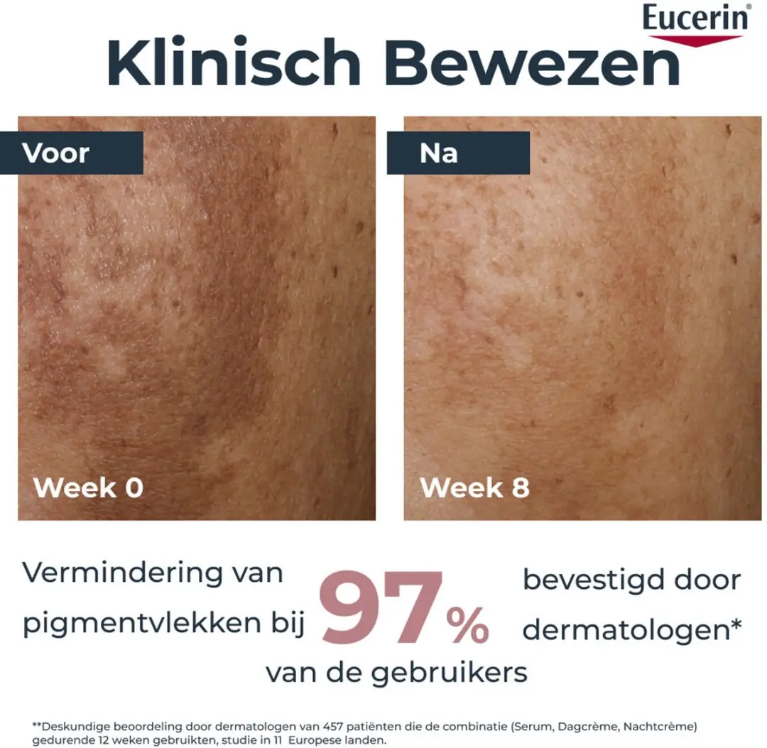 Eucerin Hyperpigmentatie Dag- & Nachtcrème Bundel 2x50ml - SPF 30